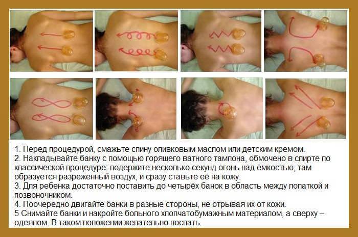 Компрессы