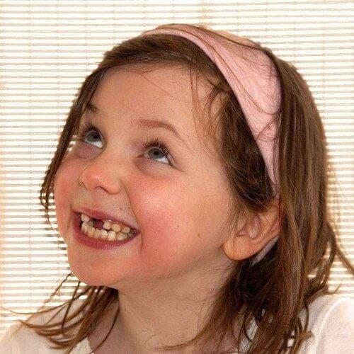 Удаляем молочный зуб у ребенка Удаление молочных зубов