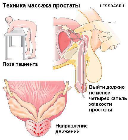 Как найти простату самому