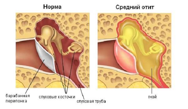 Классификация заболевания