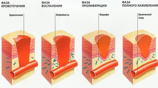 Этапы заживления ссадин