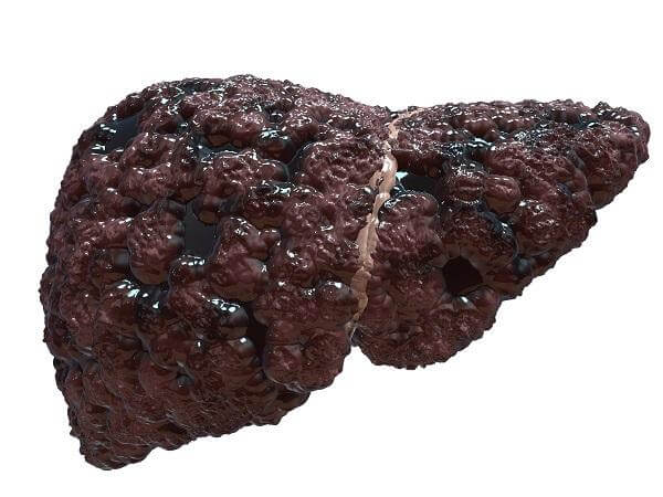 Опасность заболевания