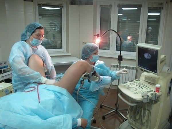 pochemu-razvivaetsya-endometrioz