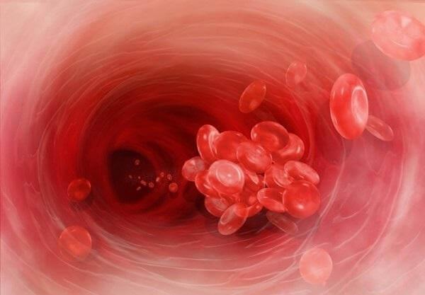 Тромбоэмболия Тромбоэмболия