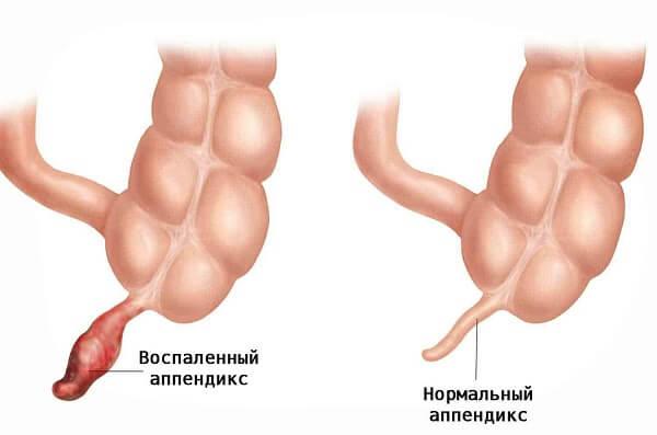 Этиология и патогенез