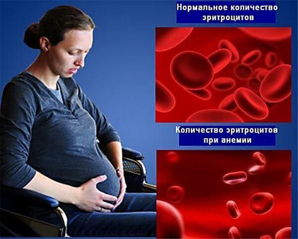 Низкий гемоглобин что это такое