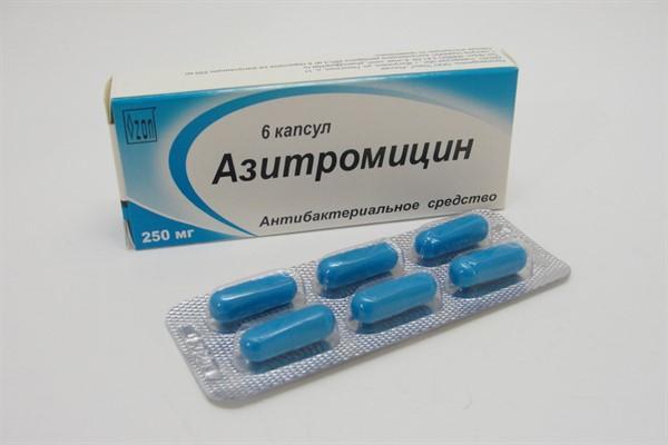 Чем лечить фарингит