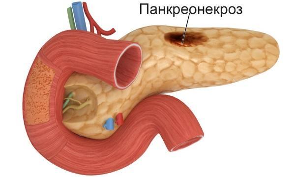 Различные виды