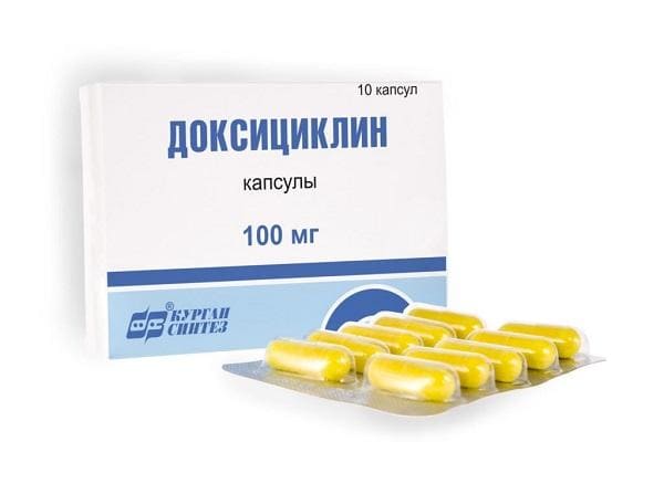 Разновидности