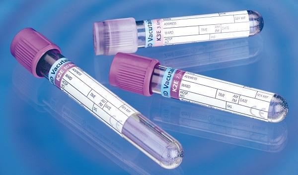 Основные составляющие Состав анализа