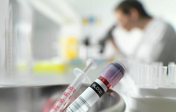 Рекомендации специалистов Подготовление