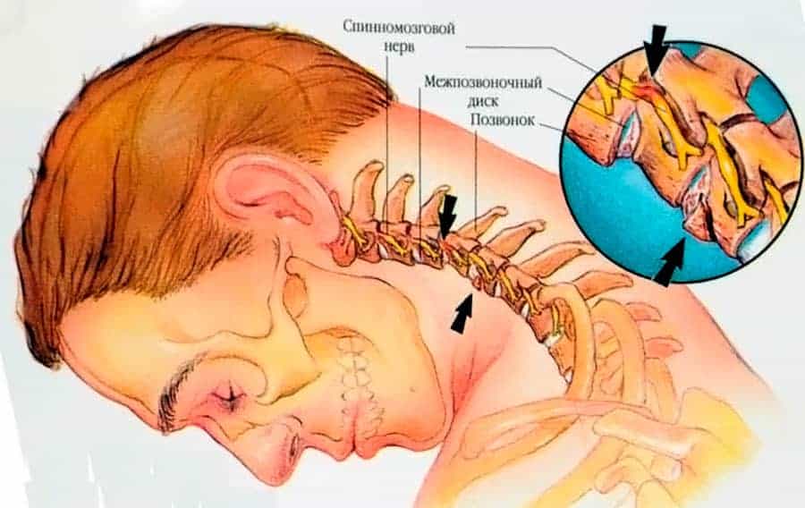 Методы диагностики и лечения вбн